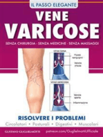 Vene varicose - Prevenire, ridurre ed eliminare