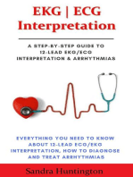 EKG | ECG Interpretation. Everything You Need to Know about 12-Lead ECG/EKG Interpretation