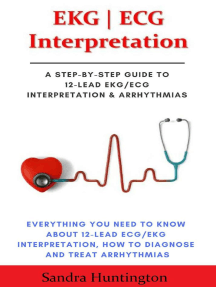 Read Ekg Ecg Interpretation Everything You Need To Know About 12 Lead Ecg Ekg Interpretation Online By Sandra Huntington Books