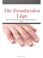 Die Frostbeulen Lüge: Wie Sie kalte Füße und Hände erfolgreich heilen