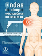 Ondas de choque extracorpóreas radiales: Aplicación en patologías músculo esqueléticas