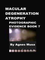 Macular Degeneration Atrophy, Photographic Evidence Book 7