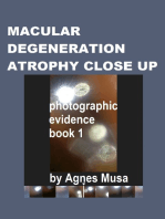 Macular Degeneration Atrophy Close Up, Photographic Evidence Book 1