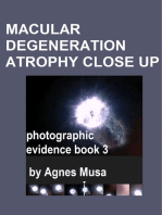 Macular Degeneration Atrophy Close Up, Photographic Evidence Book 3