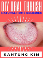 DIY Oral Thrush Natural Home Remedies