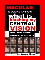 Macular Degeneration, What Is Blocking My Central Vision, Photographic Evidence Book 1