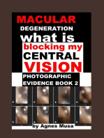 Macular Degeneration, What Is Blocking My Central Vision, Photographic Evidence Book 2
