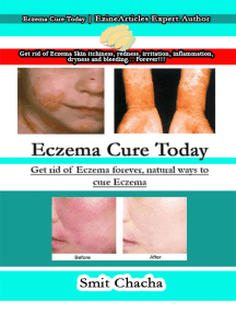 Eczema Cure Today Get Rid Of Eczema Forever Natural Ways To Cure Eczema By Smit Chacha Ebook Scribd