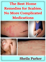 The Best Home Remedies for Scabies, No More Complicated Medications