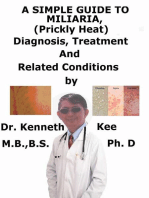 A Simple Guide To Miliaria, (Prickly Heat) Diagnosis, Treatment And Related Conditions