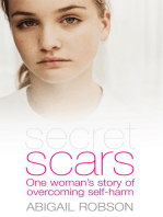 Secret Scars: One Woman's Story of Overcoming Self-Harm