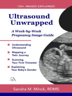 Ultrasound Unwrapped