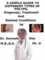 A Simple Guide to Different Types of Polyps, Diagnosis, Treatment and Related Conditions