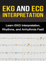 EKG and ECG Interpretation: Learn EKG Interpretation, Rhythms, and Arrhythmia Fast!