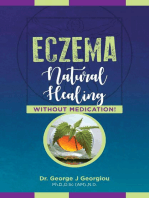 Eczema: Natural Healing, Without Medication