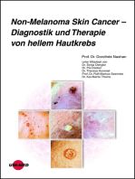Non-Melanoma Skin Cancer - Diagnostik und Therapie von hellem Hautkrebs
