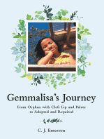 Gemmalisa’s Journey: From Orphan with Cleft Lip and Palate to Adopted and Repaired