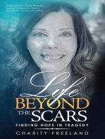 Life Beyond the Scars: Finding Hope in Tragedy