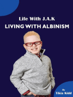 Life With J.A.K Living with Albinism: Living with Albinism