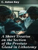 A Short Treatise on the Section of the Prostate Gland in Lithotomy