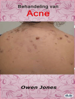 Behandeling Van Acne