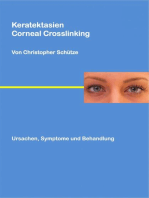 Keratektasien: Corneal Crosslinking