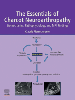 The Essentials of Charcot Neuroarthropathy: Biomechanics, Pathophysiology, and MRI Findings