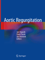 Aortic Regurgitation