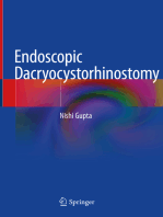 Endoscopic Dacryocystorhinostomy