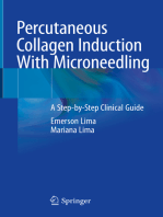 Percutaneous Collagen Induction With Microneedling: A Step-by-Step Clinical Guide