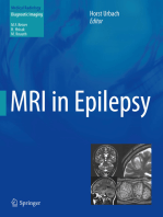 MRI in Epilepsy