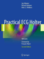 Practical ECG Holter: 100 Cases