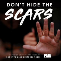 Don’t Hide The Scars. Presented By PAIN: Parents &amp; Addicts In Need