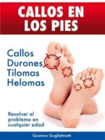 CALLOS EN LOS PIES - Solución definitiva para Callos, Tilomas y Helomas.