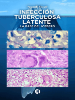 Infección Tuberculosa Latente, la base del iceberg