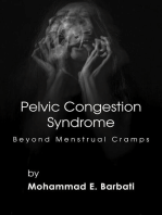 Pelvic Congestion Syndrome - Beyond Menstrual Cramps