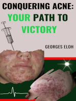 Conquering Acne: Your Path to Victory