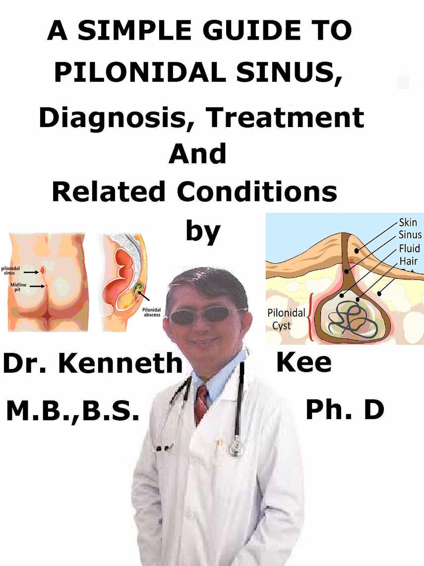 A Simple Guide to Pilonidal Sinus, Diagnosis, Treatment and Related ...
