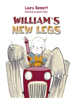 William's New Legs