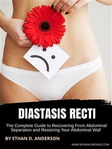 Diastasis Recti by Ethan D. Anderson - Ebook