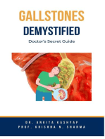 Gallstones Demystified: Doctor’s Secret Guide