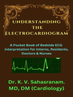 Understanding the Electrocardiogram