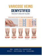 Varicose Veins Demystified: Doctor's Secret Guide