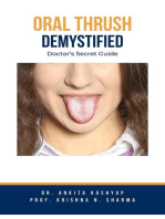 Oral Thrush Demystified: Doctor's Secret Guide