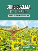 Cure Eczema Naturally - The Key to Lifelong Healthy Skin