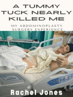 A Tummy Tuck Nearly Killed Me