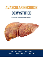 Avascular Necrosis Demystified: Doctor’s Secret Guide