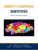 Barretts Esophagus Demystified: Doctor’s Secret Guide