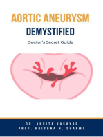 Aortic Aneurysm Demystified: Doctor’s Secret Guide