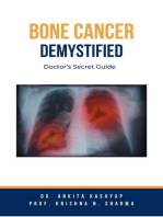 Bone Cancer Demystified: Doctor’s Secret Guide